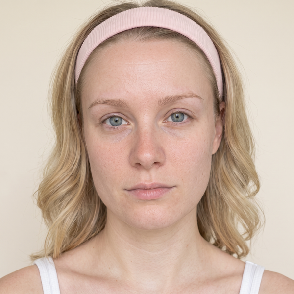 After - I Got the Glow—Not the Burn